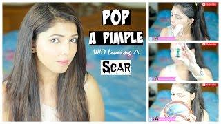 Get Rid Of A Pimple Without Leaving Any Scar  Hina Attar