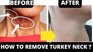  STOP TURKEY NECK and NECK WRINKLES  ANTI-AGING EXERCISES FOR NECK & CHEST  FULL COLLECTION