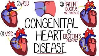 Congenital Heart Malformations Made Easy 8 Main Types