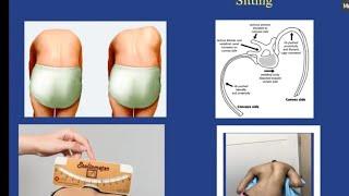 Scoliosis for the FRCS Orth exam