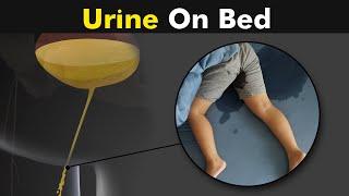 Why Childs and some adults do urine on bed?  Bedwetting - Causes and treatment UrduHindi