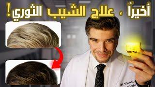 وصفة الشيب الجبارة سر الشيب المبكر وعلاجه الطبيعي الاحدث