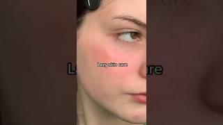 Lazy Skin Care  #shorts #skincare #glowup