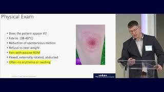 18  Septic Hip and Osteomyelitis Donald Kephart MD