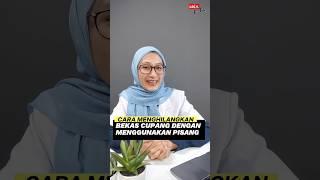 CARA MENGHILANGKAN BEKAS CUPANG DENGAN KULIT PISANG #bekascupang #bekasciuman