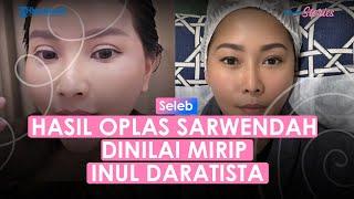 Hasil Oplas Dinilai Mirip Inul Daratista Sarwendah Tunggu 3 sampai 6 Bulan Hasilnya Maksimal