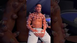 ANTHONY JOSHUA TREATING HIMSELF TO CUPPING HIJAMA THERAPY BEFORE DANIEL DUBOIS TRAINING CAMP