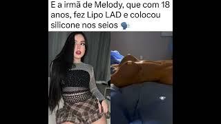 Bella Angel irmã da Melody faz cirurgia para por silicone no seios e Lipo LAD.