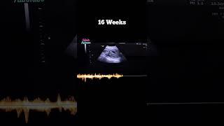 16 Weeks Pregnant  16 Minggu Kehamilan Baby H #shortsvideo #shortvideo