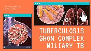 Tuberculosis  Ghon complex  Miliary TB  Progressive pulmonary TB  Rankes complex