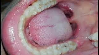 My mouth