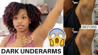 How To Lighten Dark Underarms Naturally and Fast  BEFORE AND AFTER RESULTS  journeytowaistlength