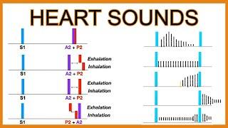 Heart Sounds Murmurs and Splitting