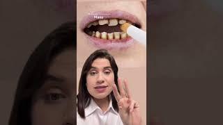 4 Principais Problemas do Cigarro para sua Saúde Sua dentista Ianara Pinho explica #brasilia #df