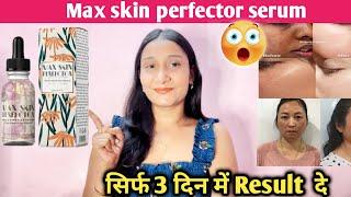 Max Skin Perfector  honest review2024