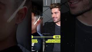 Zac Efrons Drastic Facial Transformation