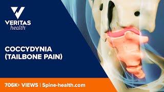 Coccydynia Tailbone Pain