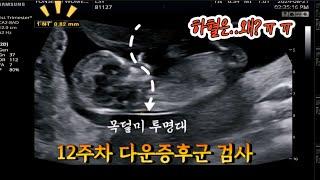 임신브이로그. 11주차14주차 기록 자궁경부암  다운증후군기형아검사1차  갑자기 하혈? 왜?