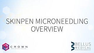 SkinPen Microneedling Overview