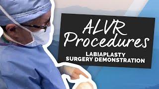 ALVR Procedures Labiaplasty Surgery Demonstration