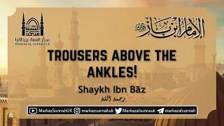 Trousers Above the Ankles  Shaykh Ibn Baz