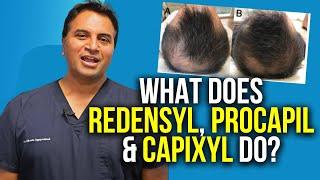 Redensyl Procapil and Capixyl For Hair Growth?