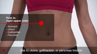 Common causes of abdominal pain