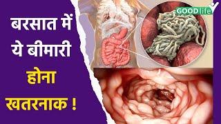 Amoebiasis Disease क्या है  Symptoms Reason और कैसे लें Precautions  Amoebasis Kya Hai Good Life