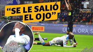 Escalofriante lesión de jugador del Napoli “se le salió el ojo”  Telemundo Deportes