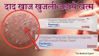 PANDERM-NM CREAM  FOR FUNGAL INFECTION AND SKIN CREAM  HINDI  THE MEDICAL EXPERT
