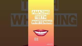 Teeth whitening LIVE DEMO Dr. Srishti Bhatia