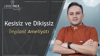 Kesisiz ve Dikişsiz İmplant Ameliyatı Dentince #implant