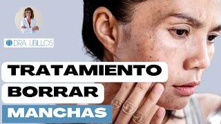 EL MEJOR TRATAMIENTO PARA BORRAR LAS MANCHAS DEL SOL