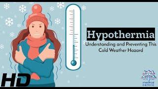 Hypothermia The Cold Truth and How to Stay Warm