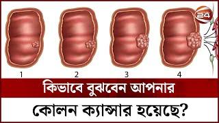 কিভাবে বুঝবেন আপনার কোলন ক্যান্সার হয়েছে?  Colon Cancer Symptoms  Channel 24