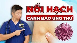 4 Dấu Hiệu Nổi Hạch Cảnh Báo Tình Trạng Ung Thư Cần Lưu Ý  Dr Ngọc