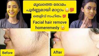 മുഖത്തെ രോമം പൂർണമായി മാറ്റാംfacial hair remove at homelive result #facialhairremoval