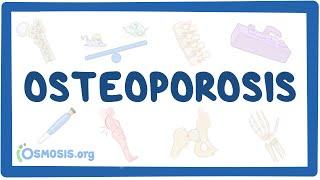 Osteoporosis - causes symptoms diagnosis treatment pathology