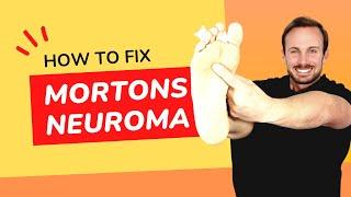 Shooting Sharp Foot Pain  Mortons Neuroma  Treatment No Surgery