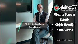 TÜP MİDE AMELİYATI SONRASI ESTETİK Karın Germe