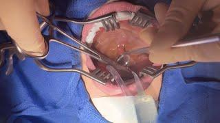 ASMR Surgery Tonsillectomy  Doctor & Patient POV  Post-Op Cranial Nerve Exam