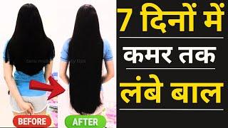 7 दिनों में कमर तक लंबे घने बाल - Natural Remedy for Thick Long Hair  Hair Growth in 7 Days