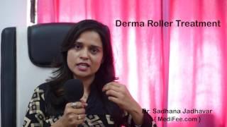 Derma Roller - Treatment for Acne Scars and Stretch marks