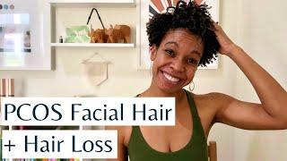 PCOS Facial Hair and Hair Loss  Causes Treatments & Natural Ways to Reduce Hirsutism & Hair Loss