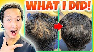 How I Treated My Thinning Hair the Holistic Way