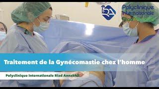 Opération  Traitement de la Gynécomastie chez lhomme avec Dr Salma Ouezzani