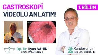 Endoskopi Gastroskopi  İşlemi Nasıl Yapılır? Endoskopi Gastroskopi İşlemi Videolu Anlatımı