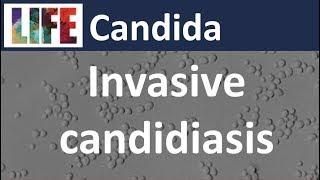 Invasive Candida