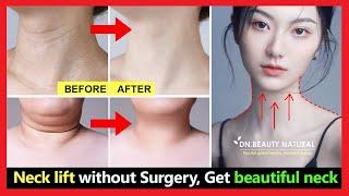 Neck lift without surgery Get rid of tech neck lines lose neck fat fix saggy neck and turkey neck
