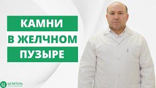 УДАЛЯТЬ ЖЕЛЧНЫЙ ПУЗЫРЬ ИЛИ НЕТ? ЖЕЛЧЕКАМЕННАЯ БОЛЕЗНЬ